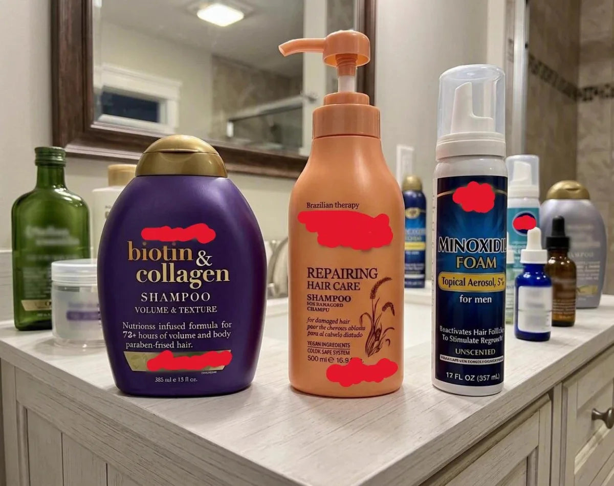 A bathroom counter full of hair shampoos, serums and minoxidil foam that did not work